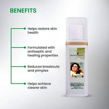 Shahnaz Husain Shaclear Plus Skin Clear Anti-Pimple Lotion | 100ml
